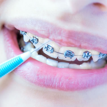 Brushing and Flossing - Richee Berry, DDS | Bowie MD